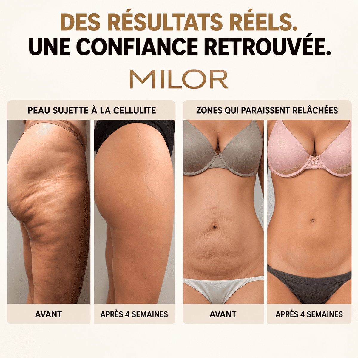 MILOR™ — Gel raffermissant à l’or