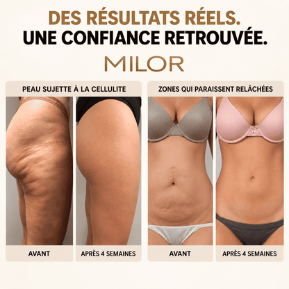 MILOR™ — Gel raffermissant à l’or